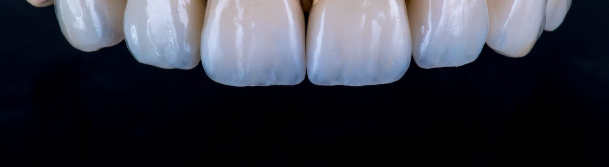 Premium cosmetic dental ceramics