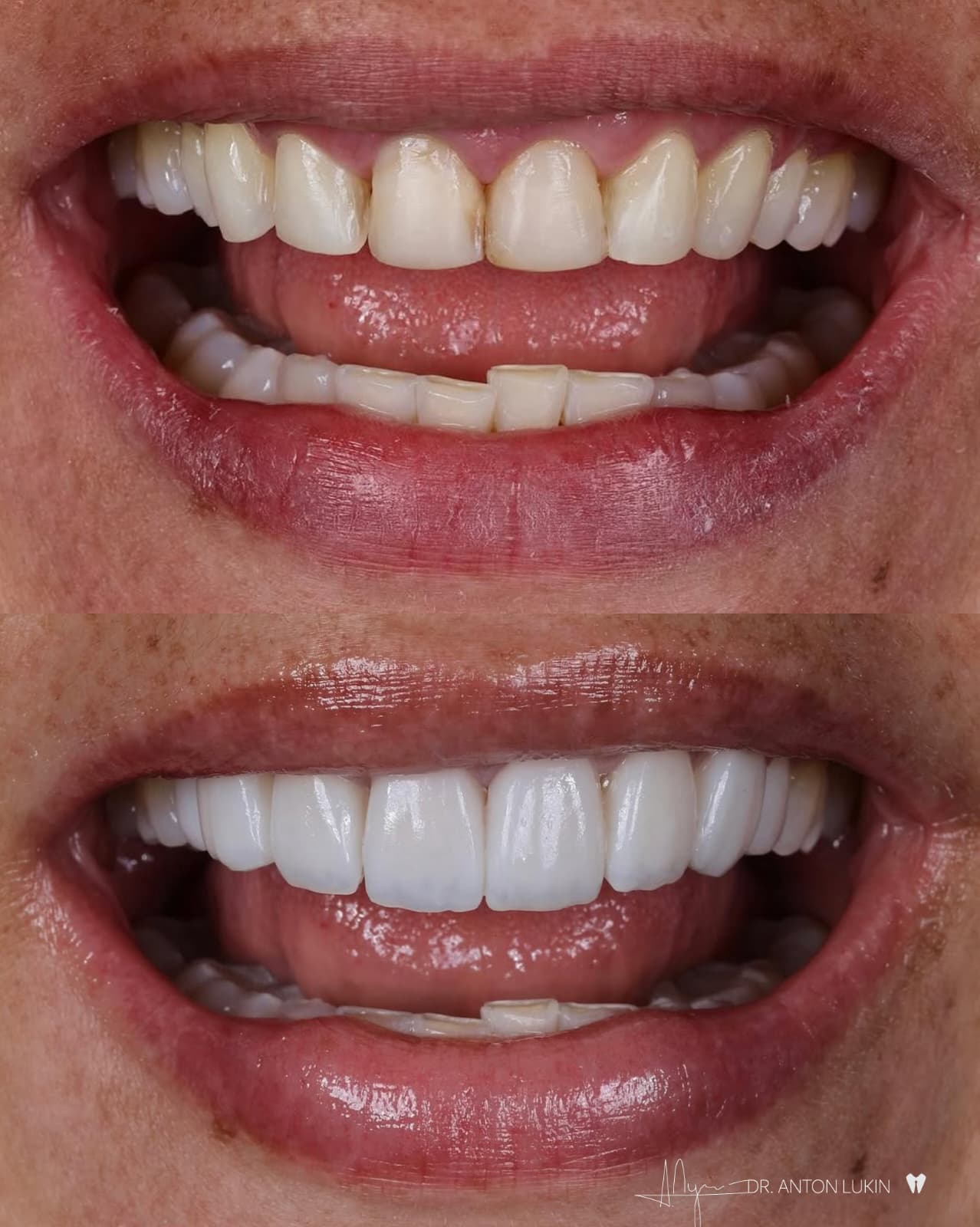 Smile Center cosmetic transformation